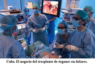 Cuba vende trasplantes cardíacos a 70 mil dólares norteamericanos